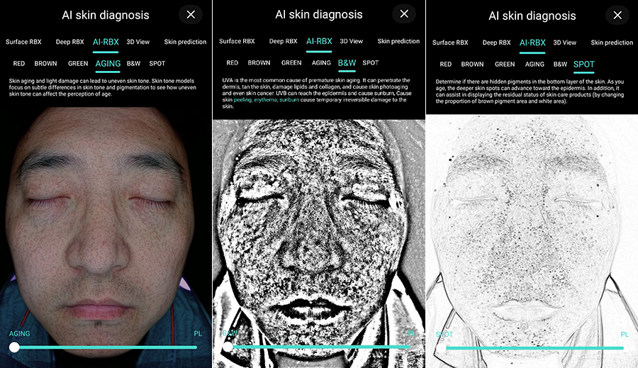 ¿Por qué cada vez más centros de estética utilizan Skin Analyzer?