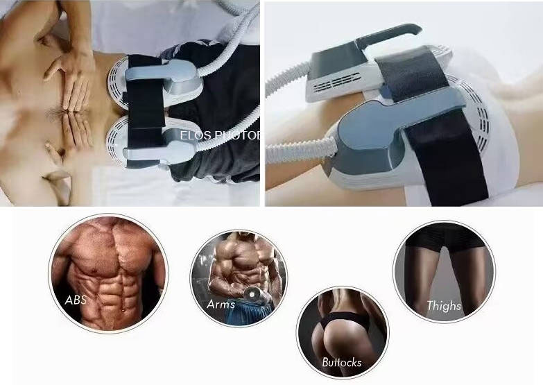 ¿Por qué la máquina de esculturas EMS se está volviendo cada vez más popular en todo el mundo?